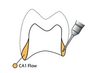 Cervical01